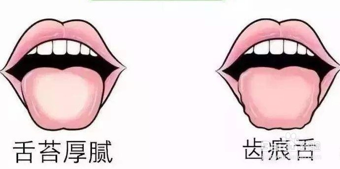 体内湿气重,寒湿与湿热如何进行区分和调养