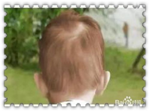 宝宝头发稀疏发黄怎么办？