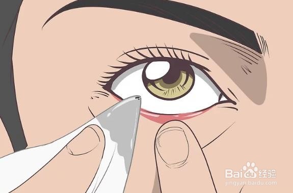 眼睛里进东西怎么弄出来小窍门