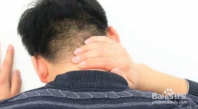 睡觉落枕了怎么办