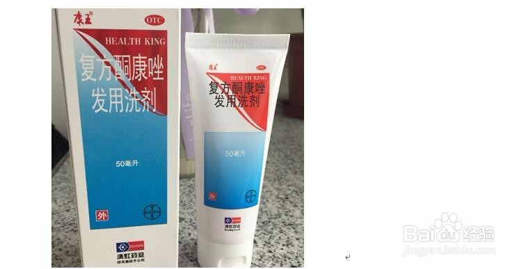 职场男士怎样才能去除头皮屑