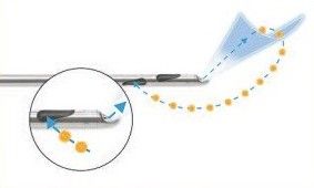 水动力吸脂对比图