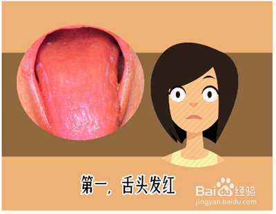 中医如何看舌苔及身体调理