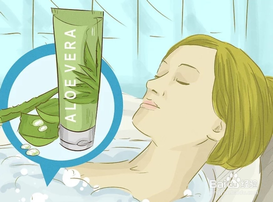 怎样用芦荟治疗灼伤？