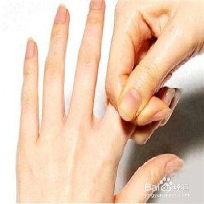 手部干燥起皮怎么办