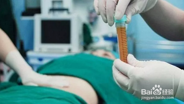 什么是填脂肪、自体脂肪填充大约需要多少钱？