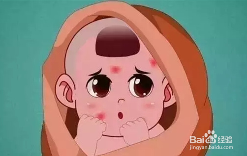 鲜红斑痣能彻底治愈吗？身上有红胎记严重吗？