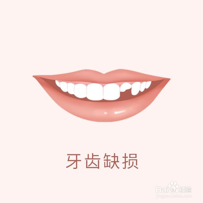 牙齿矫正类型