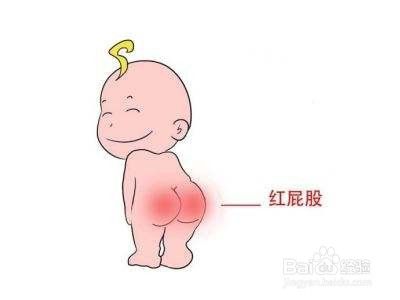 婴儿红屁屁的预防 百度经验