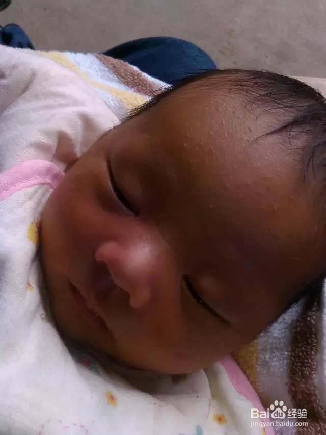 关于小婴儿发烧的一点建议