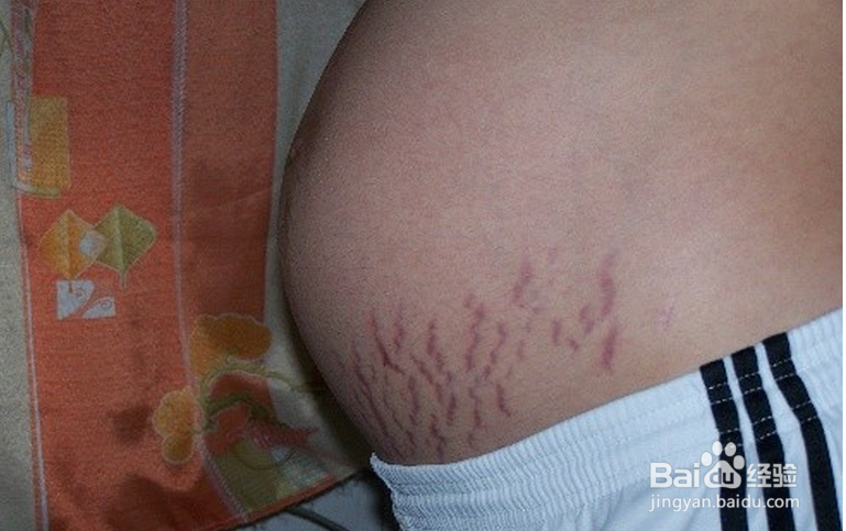 孕妈妈如何呵护自己