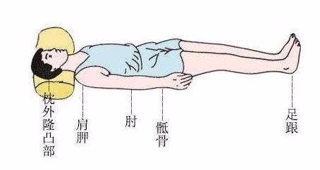 长期卧床褥疮怎么办