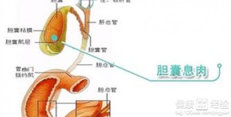 怎样控制胆囊息肉长大