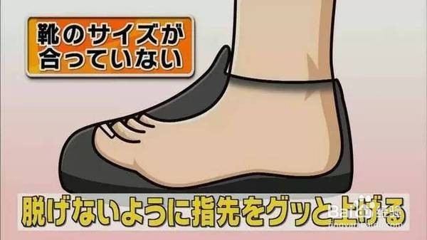 小腿粗怎么办？教你如何瘦小腿！