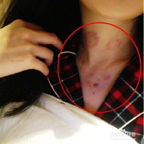 怎样用化妆做假吻痕 ?