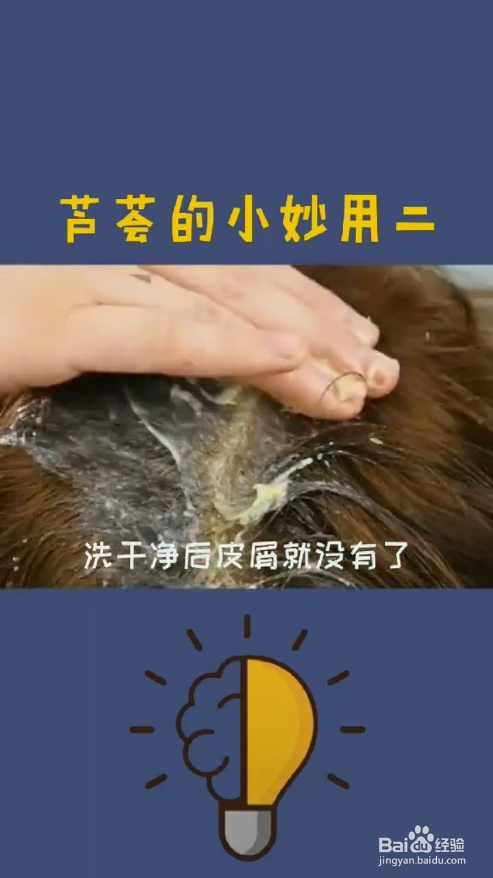 芦荟的小妙用