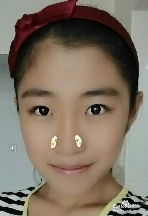 脸上痘痘的位置告诉你哪里出了问题