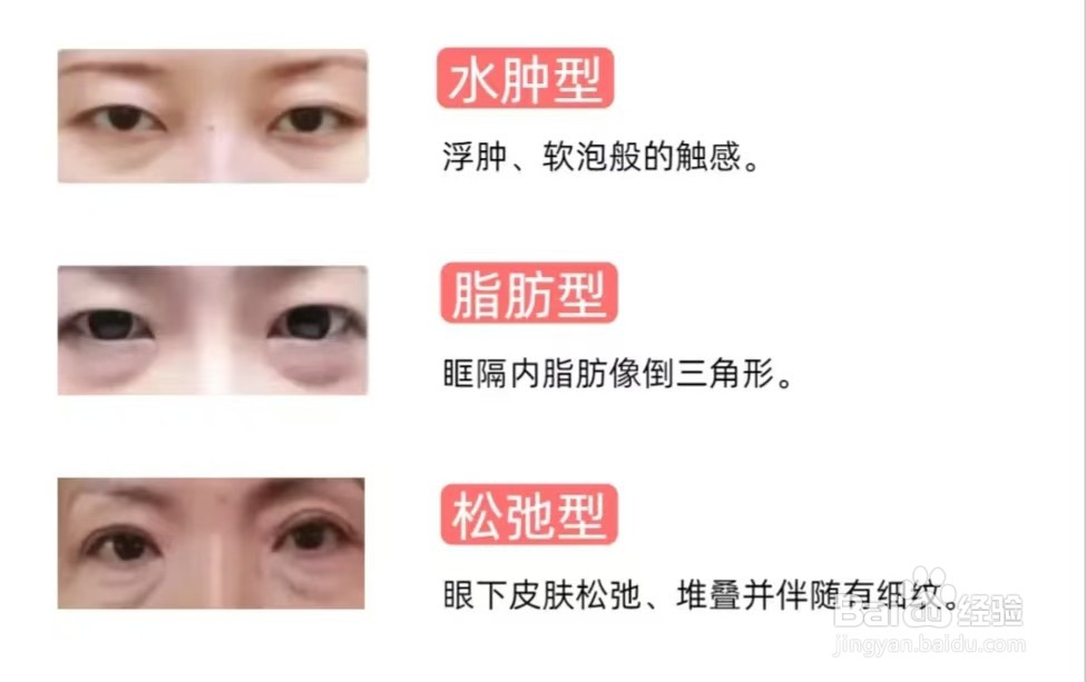 如何去除下眼袋