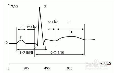 q-t間期延長見於:心肌損害,心肌缺血