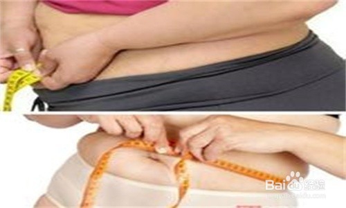 高脂饮食与动脉粥样硬化