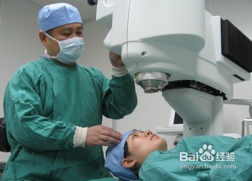 散光应该做哪些检查