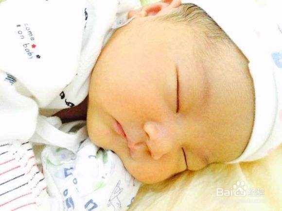 应对宝宝黄疸,妈妈你应该怎么办?