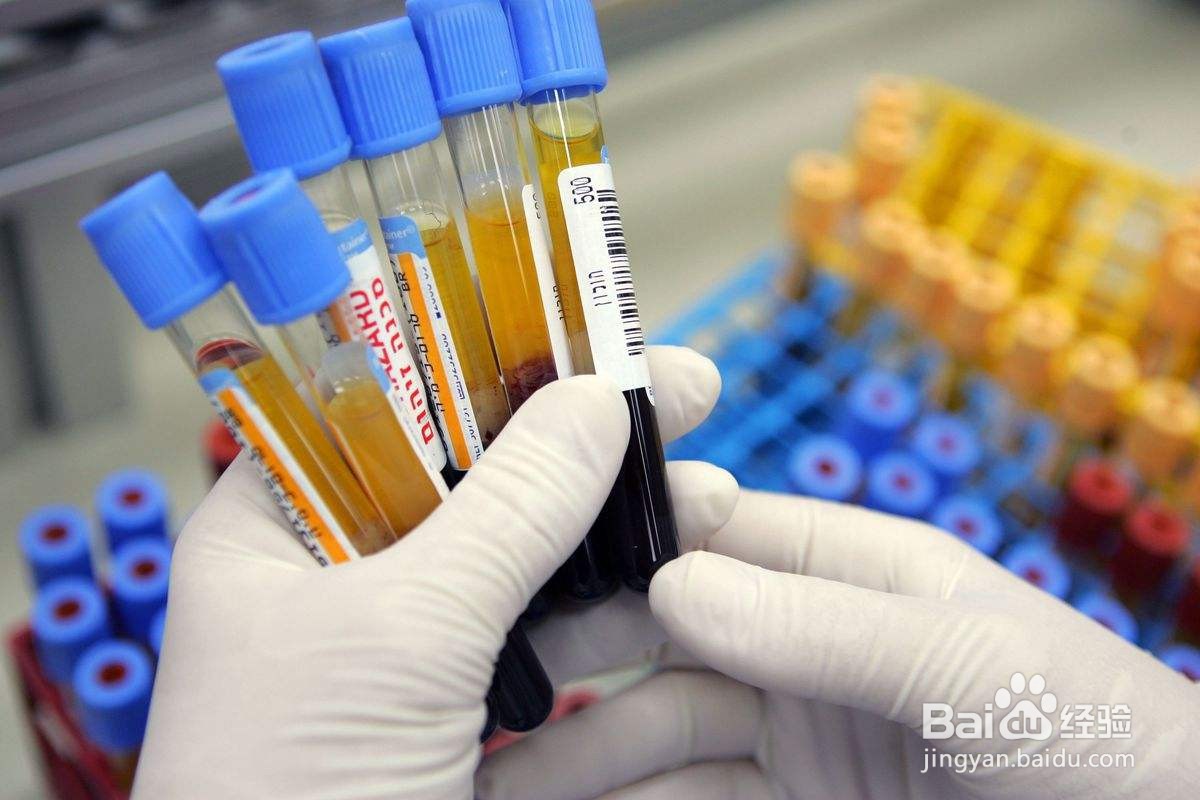 如何寻找过敏原