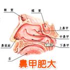 鼻甲肥大的诊断方法