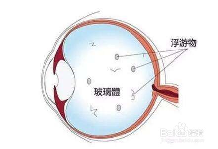 初中生物:眼球的结构
