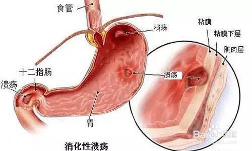 身体垃圾超标的六个信号