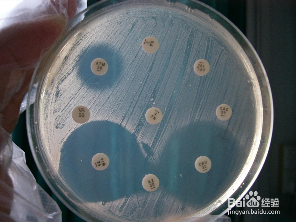 2014年执业药师考试辅导之合理使用抗生素