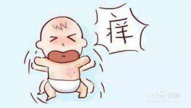 婴儿湿疹怎么办这些重点宝妈们一定要牢记