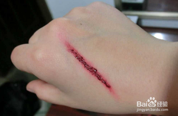 打了狂犬疫苗后的注意事项