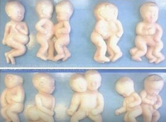 孕中期是否需要做糖筛