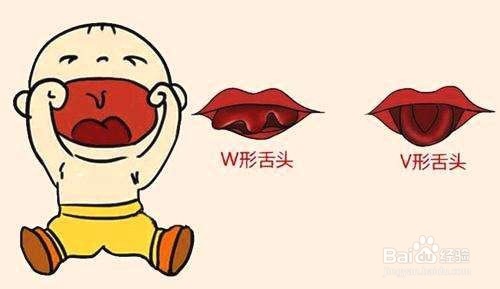 宝宝吐字不清的原因