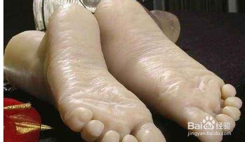 冬季脚裂口是什么原因