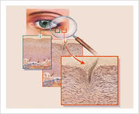 眼袋是怎么形成的