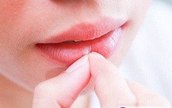 秋冬嘴唇干裂掉皮，出血怎么办?