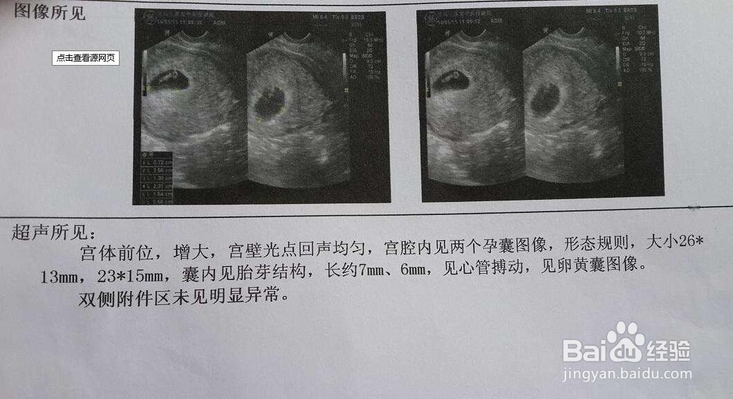 国际和平妇幼保健院建卡要求和建卡流程攻略