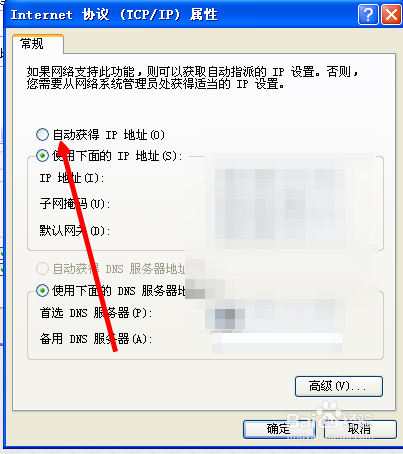 本地连接怎么自动获取IP
