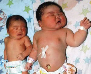 胎儿也要减肥吗?