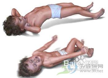 预防羊癫疯的方法有哪些？