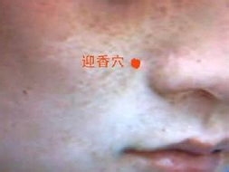 按揉可治小儿便秘