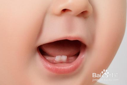 宝宝乳牙萌出时间差异原因都有哪些？