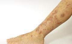 变废为宝 -------玉米须