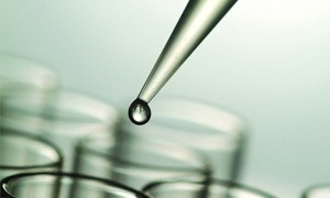 良性癫痫如何护理