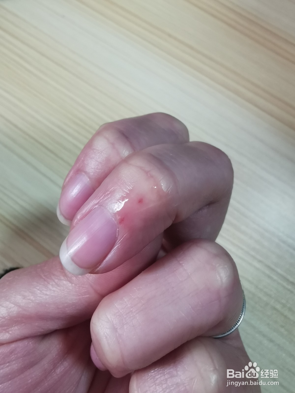 液体创可贴怎么用