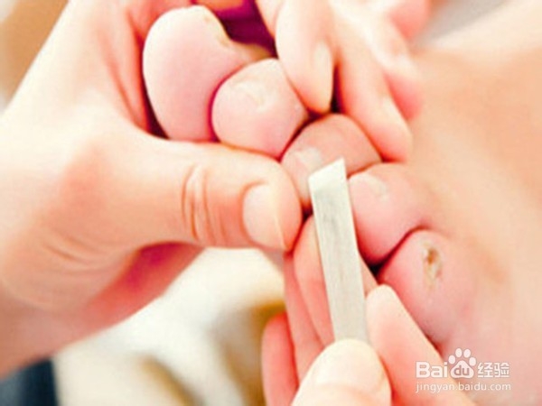 足部护理小常识