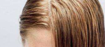 头发容易油怎么办