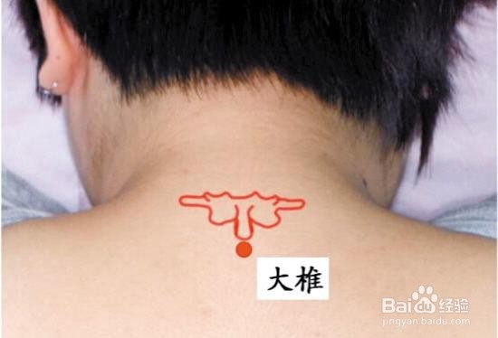 医生,我手冷脚冷怎么办呢?